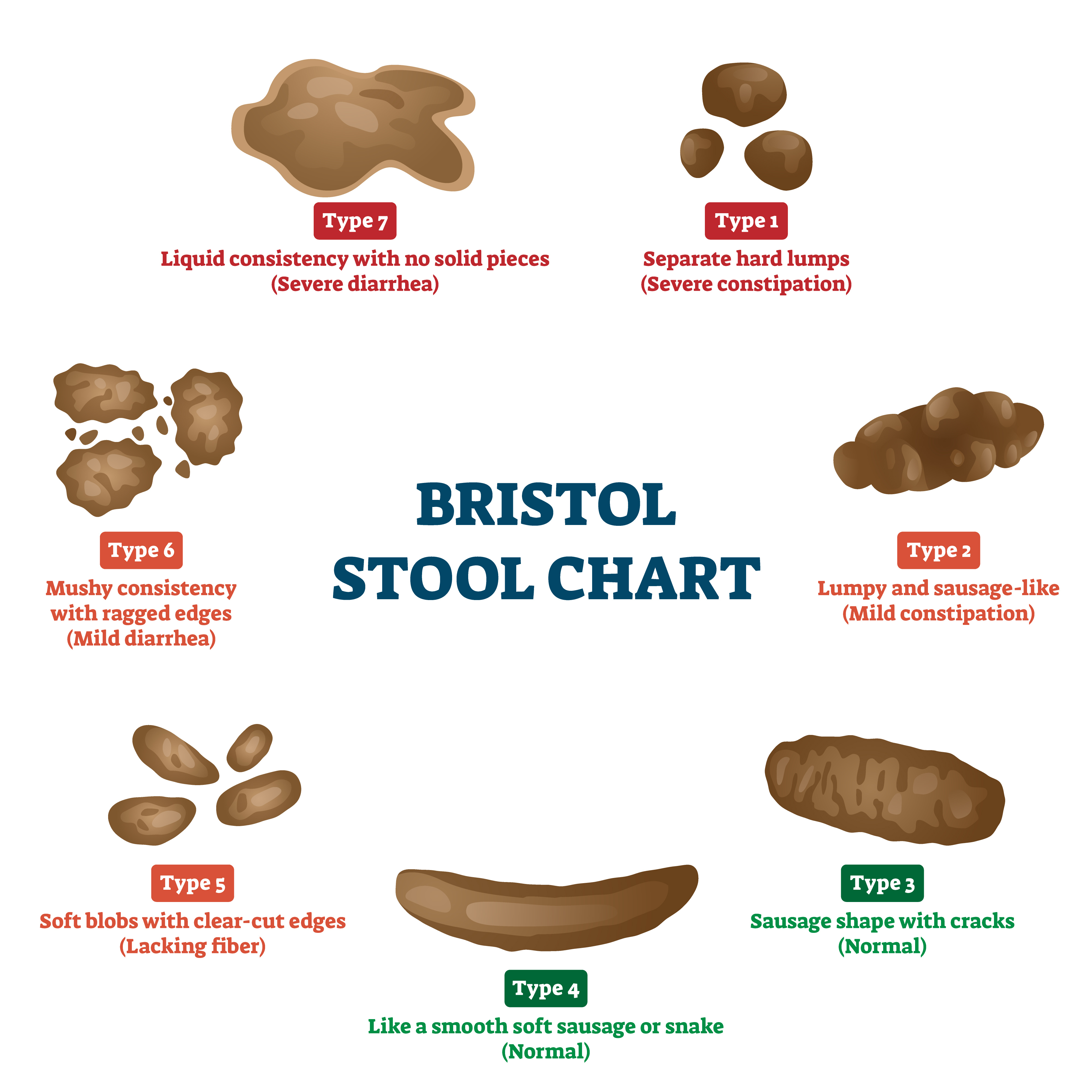 Bristol stool chart showing the range of poops from constipation to diarrhea
