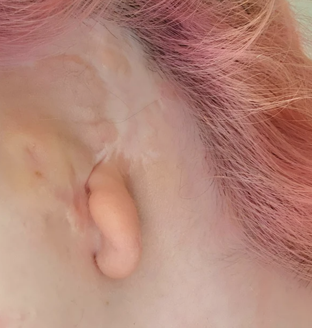 earlobe sticking out of their head