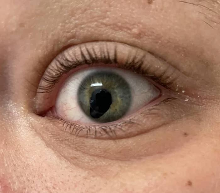 closeup of their pupil that looks like it's spilling into the rest of the eye