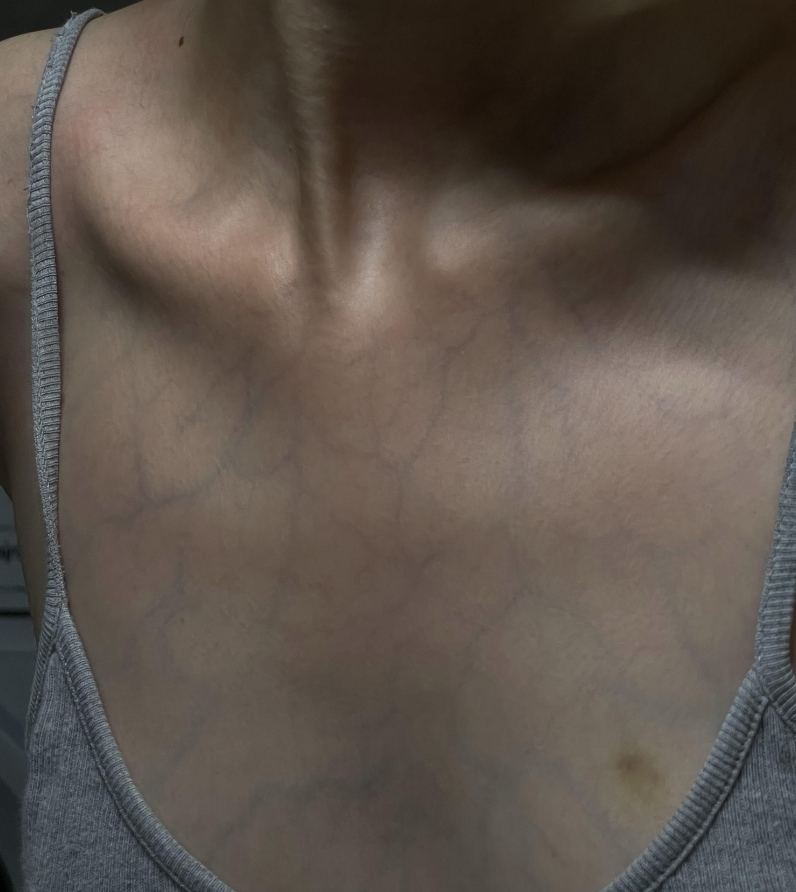you can see all the veins in their chest