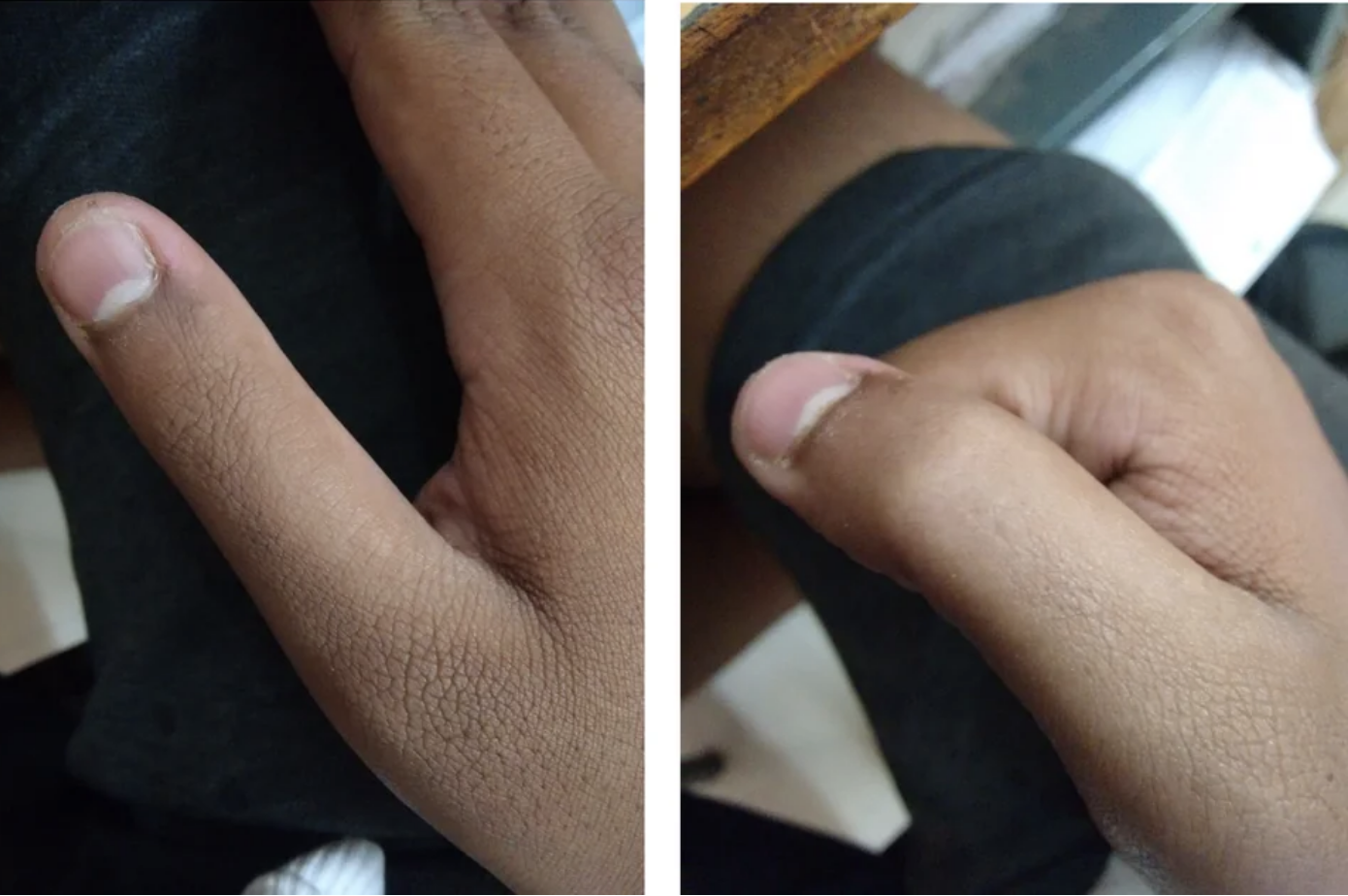 closeup of the thumb