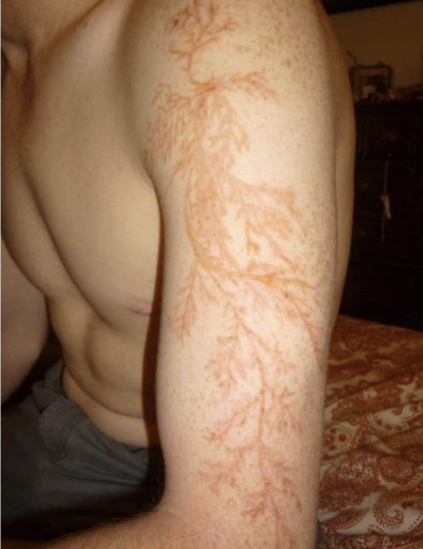 person&#x27;s arm looks like it&#x27;s tattooed with vines going down