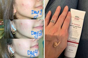 Reviewer's skin four days after using the product and review photo of the tinted sunscreen