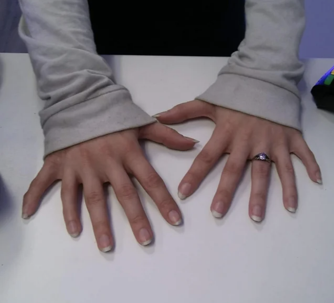 both hands laid out on the table