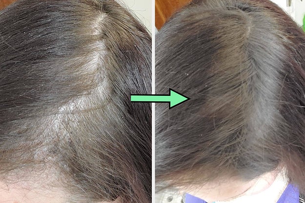 32 Before And After Pictures For Beauty Products That I See As An Absolute Win - Vimarsana News