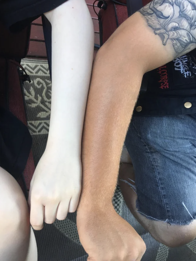Two arms side-by-side comparing their tans