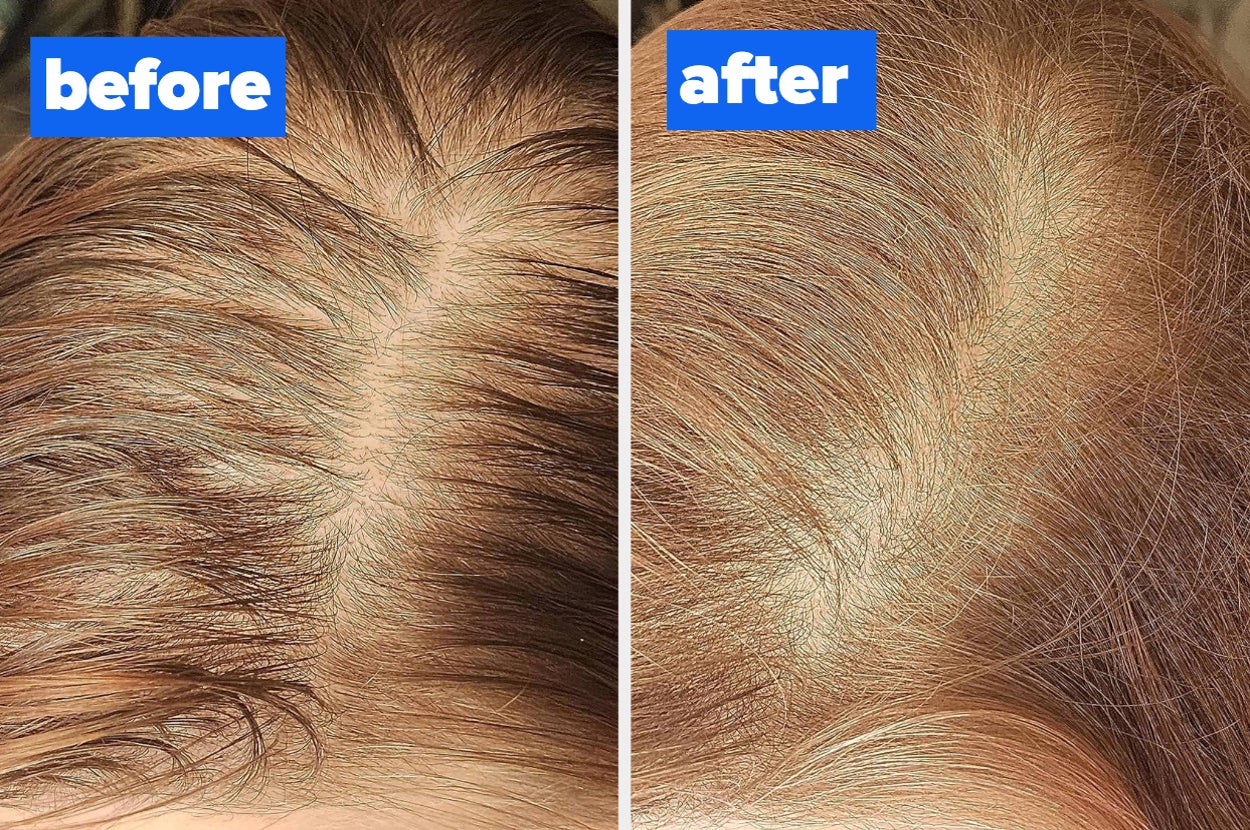 a before and after for a dry shampoo powder