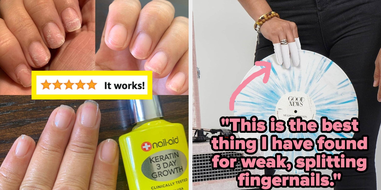 9 Effective Ways To Stop Biting Your Nails