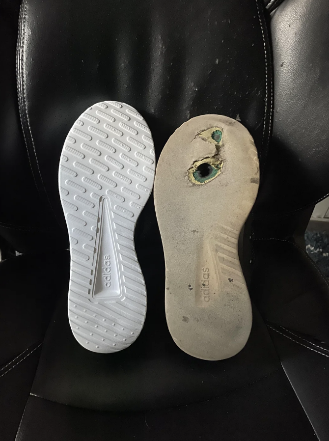 The 2-month-old shoe&#x27;s sole is dirty beige and has a hole in it, while the new shoe is white