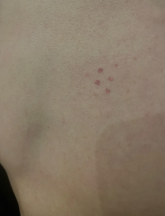 tiny red dots on someone&#x27;s skin