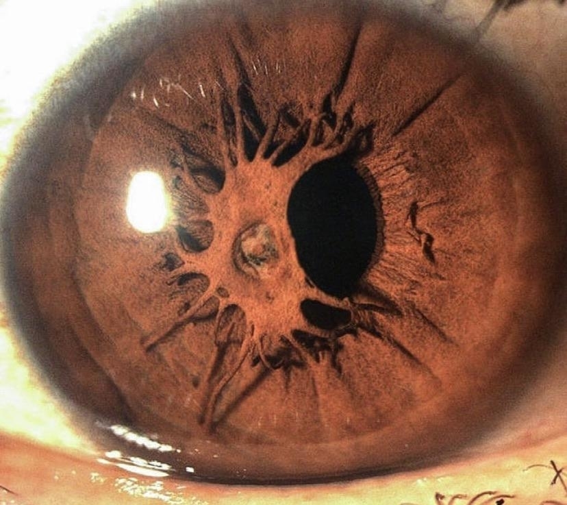 closeup of an eye