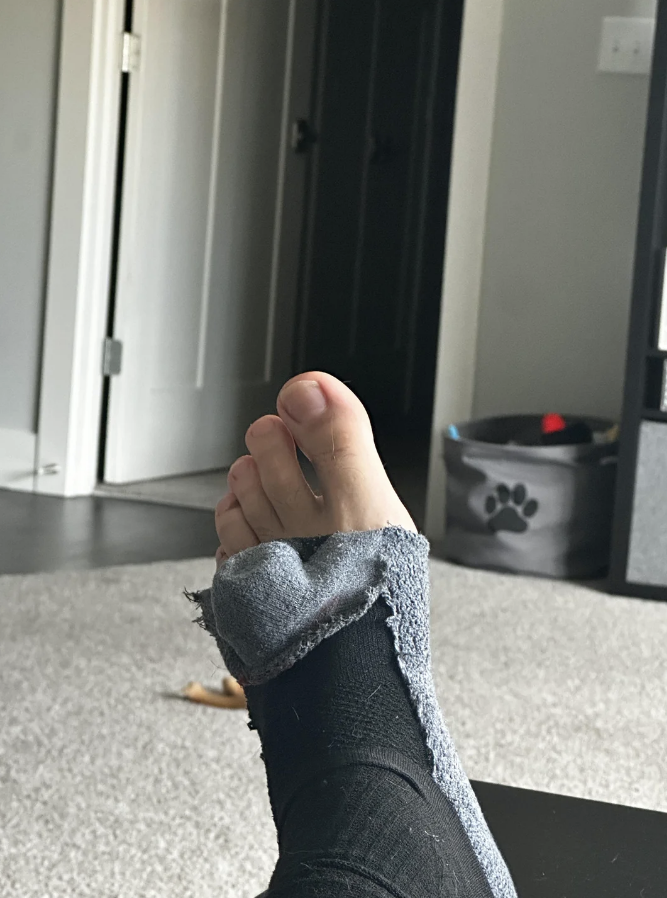 a person&#x27;s foot coming out of their sock