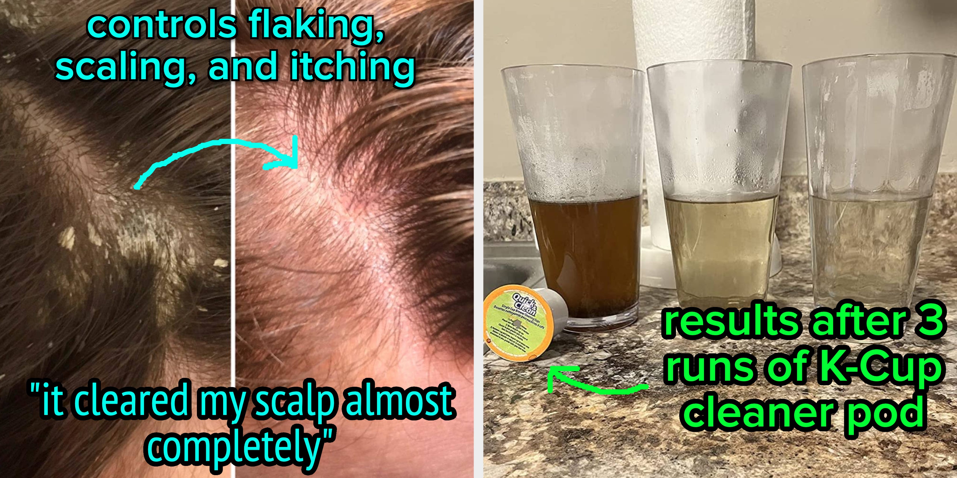 30 Products With Gross But Satisfying Before And Afters - Vimarsana News