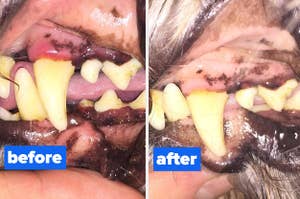 a before and after for a dental health powder