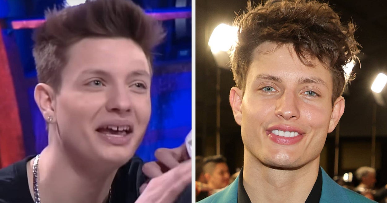 A Plastic Surgeon Joked About Creating “The Greatest Jawline” On An Unnamed Star & For Some Reason Matt Rife Responded