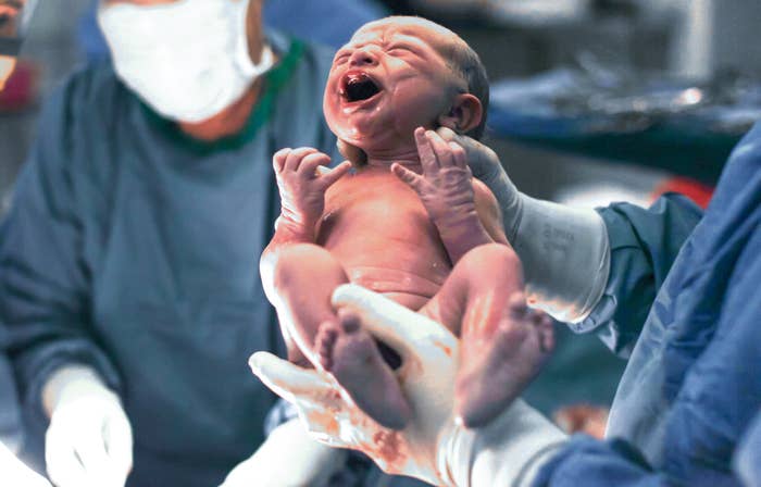 new born baby crying in the doctor&#x27;s arms
