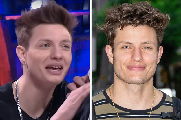 Matt Rife Responds To Plastic Surgeon&#;s "Jawline" Video