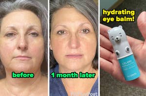 before/after of a reviewer's face after 1 month of using a retinol serum, showing decreased fine lines and dark circles / reviewer holding a polar bear shaped eye balm
