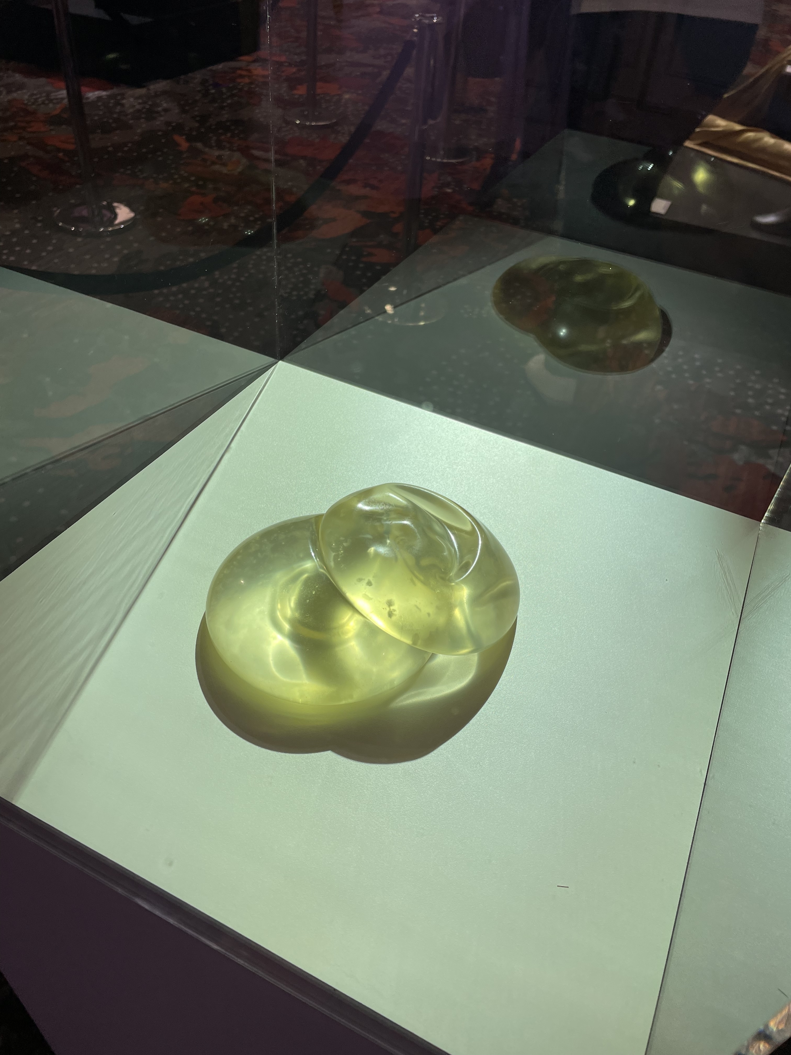 Tamra Judge&#x27;s breast implants inside a glass display box