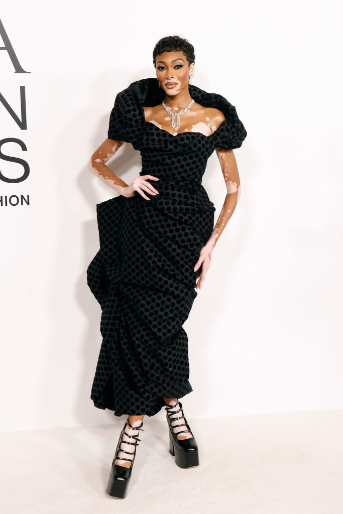 Winnie Harlow