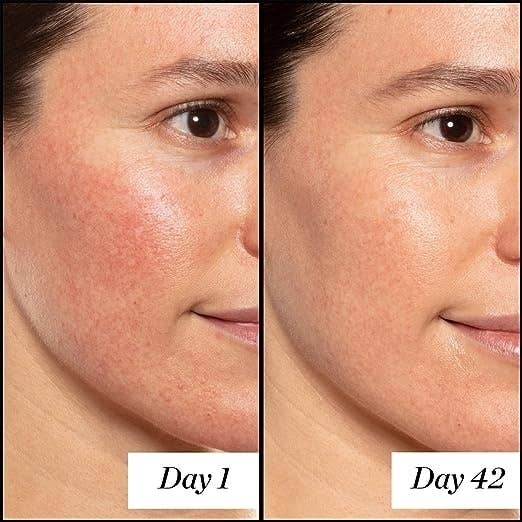 Model before and after using the product for 42 days