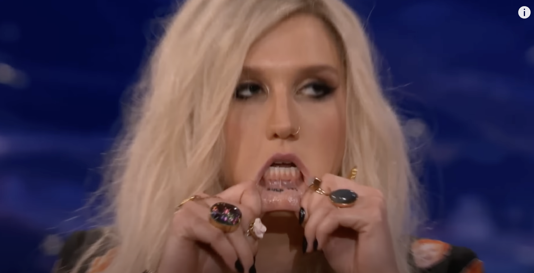 Close-up of Kesha showing her inner lip