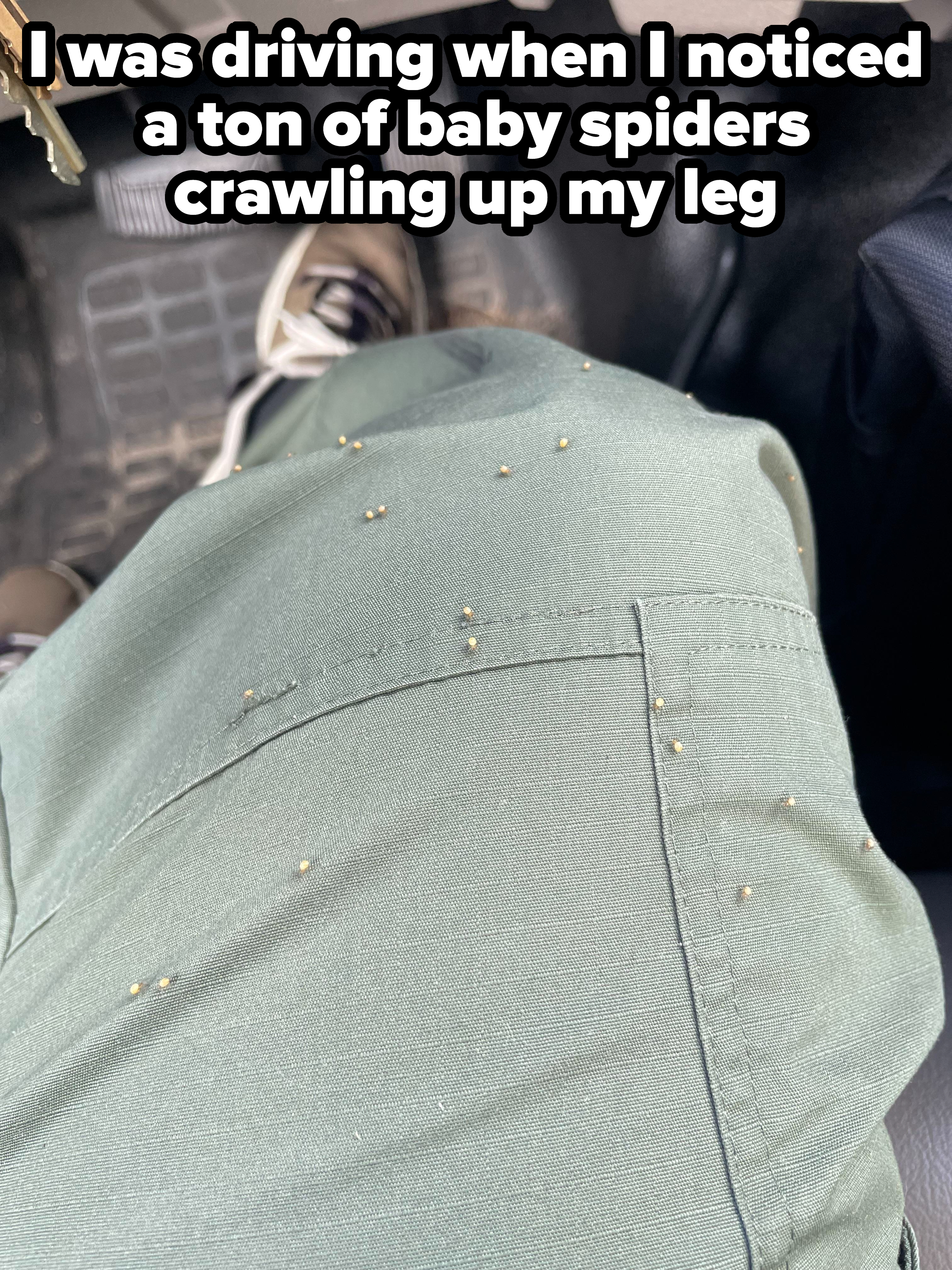 baby spiders on someone&#x27;s leg