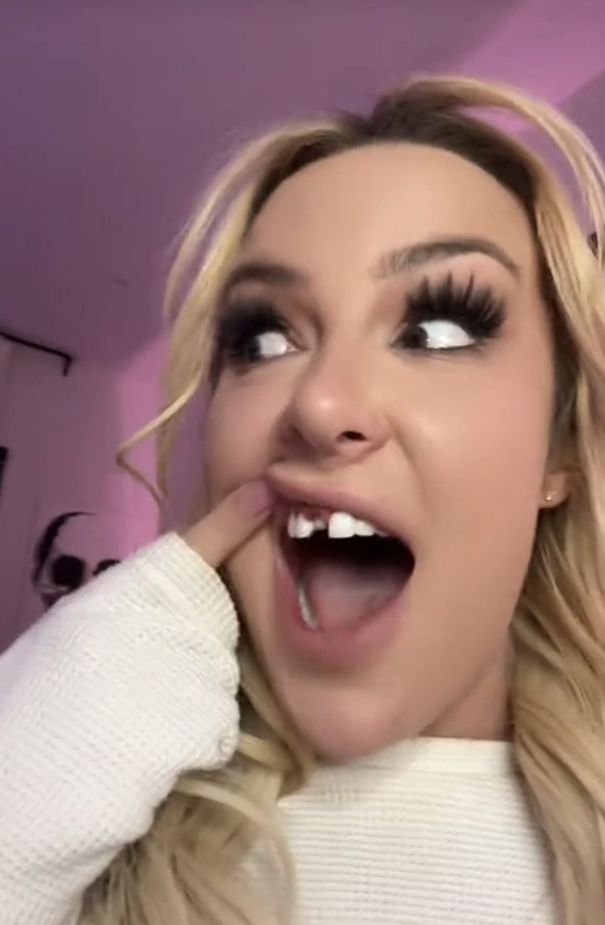 Tana lifting her upper lip to reveal the space where the veneer was