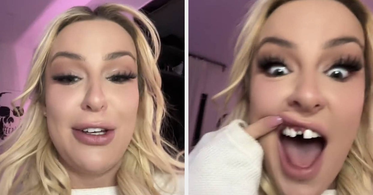 Tana Mongeau Posts Veneer Falling Out Tana Mongeau Posts Veneer Falling Out