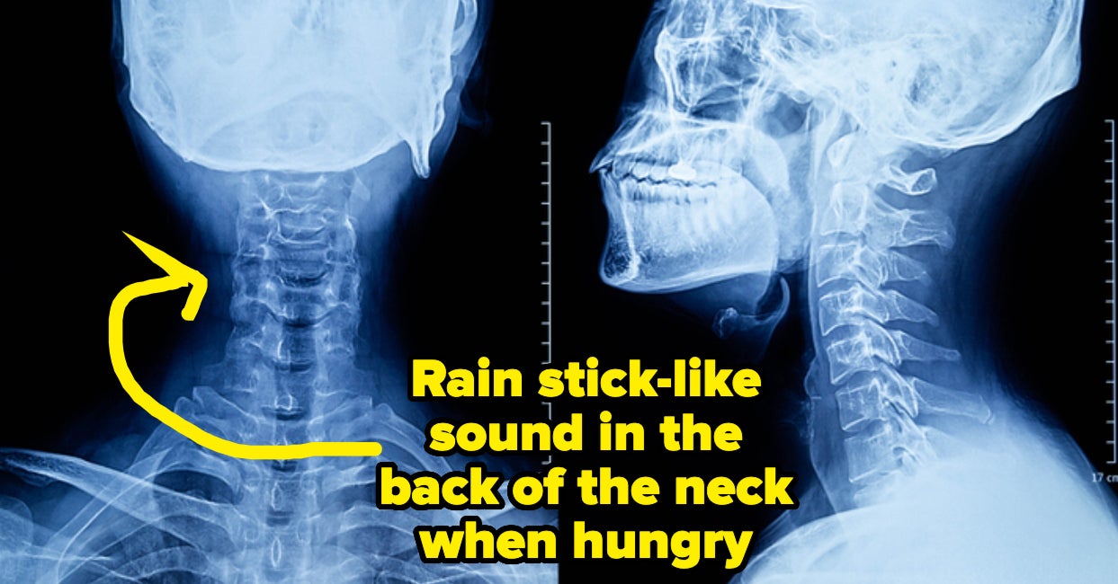 20 Unusual Things People's Bodies Do That They Didn't Know Weren't