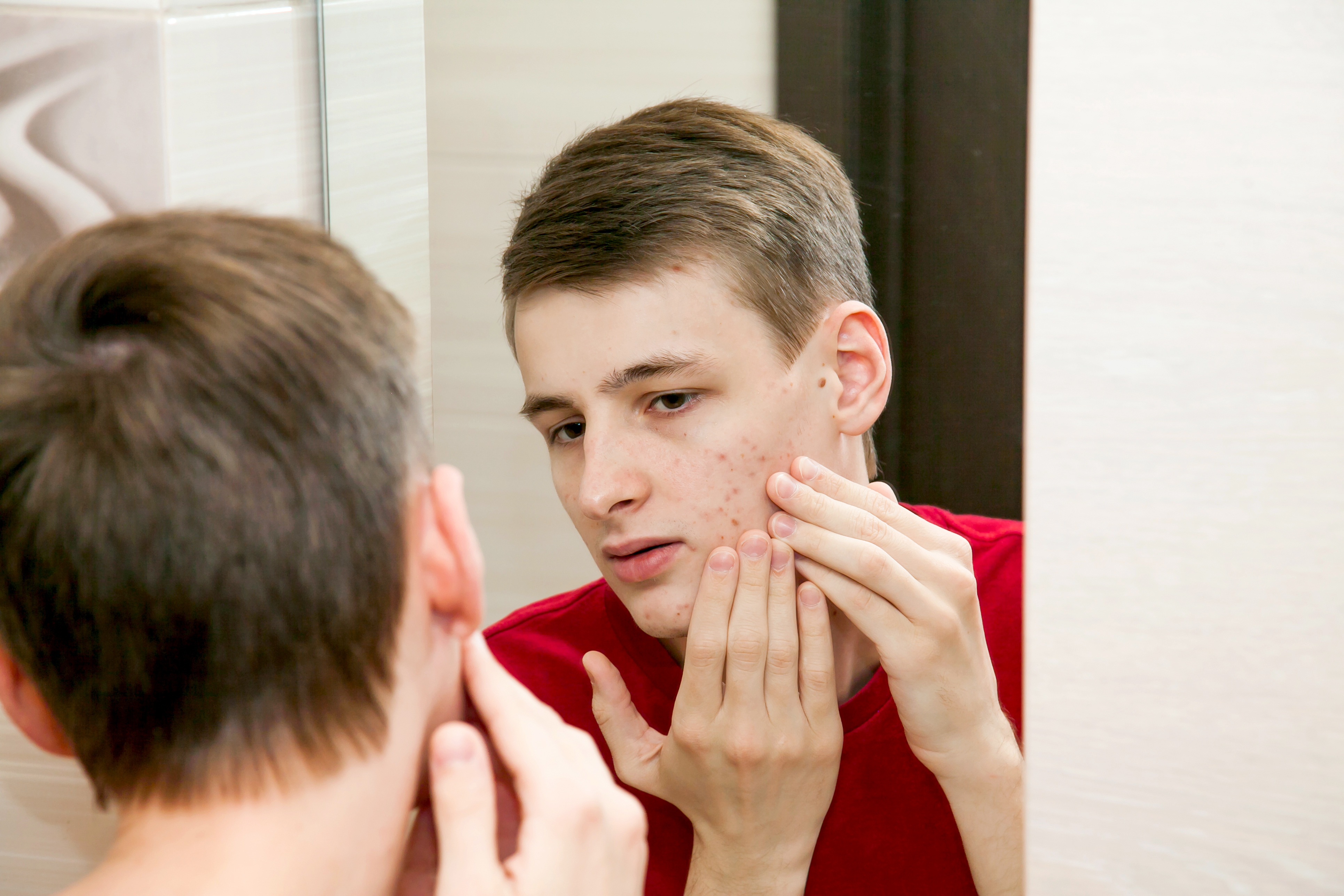 teen popping pimples in the mirror