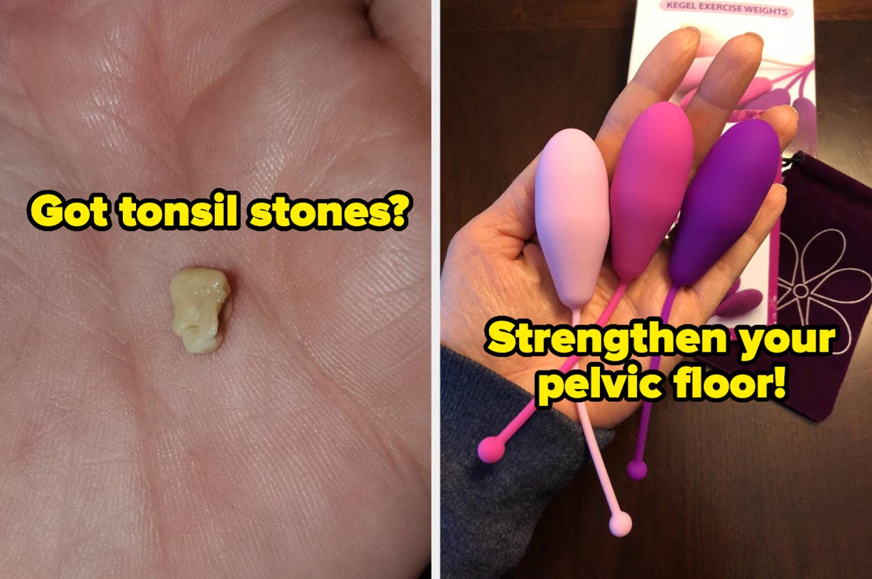 a hand holding a tonsil stone and text that reads got tonsil stones; a hand holding three kegels and text that reads strengthen your pelvic floor