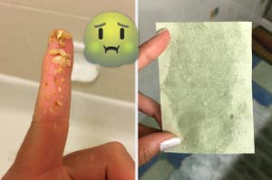 reviewer with removed earwax bits on finger and reviewer holding used blotting paper