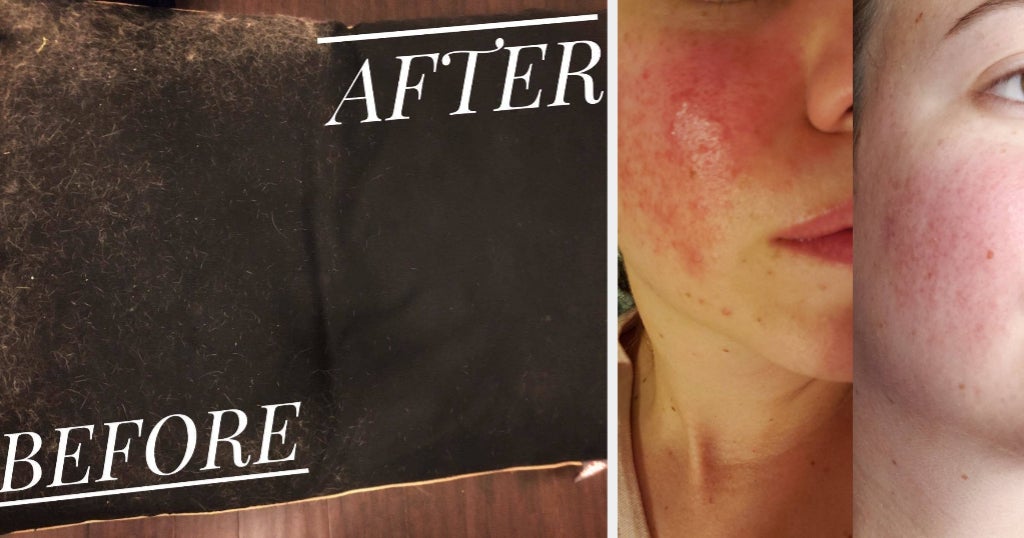 48 Products Under $25 With Dramatic Before & After Photos