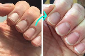 before with reviewers chip and peeled nails and after with grown out healthy nails