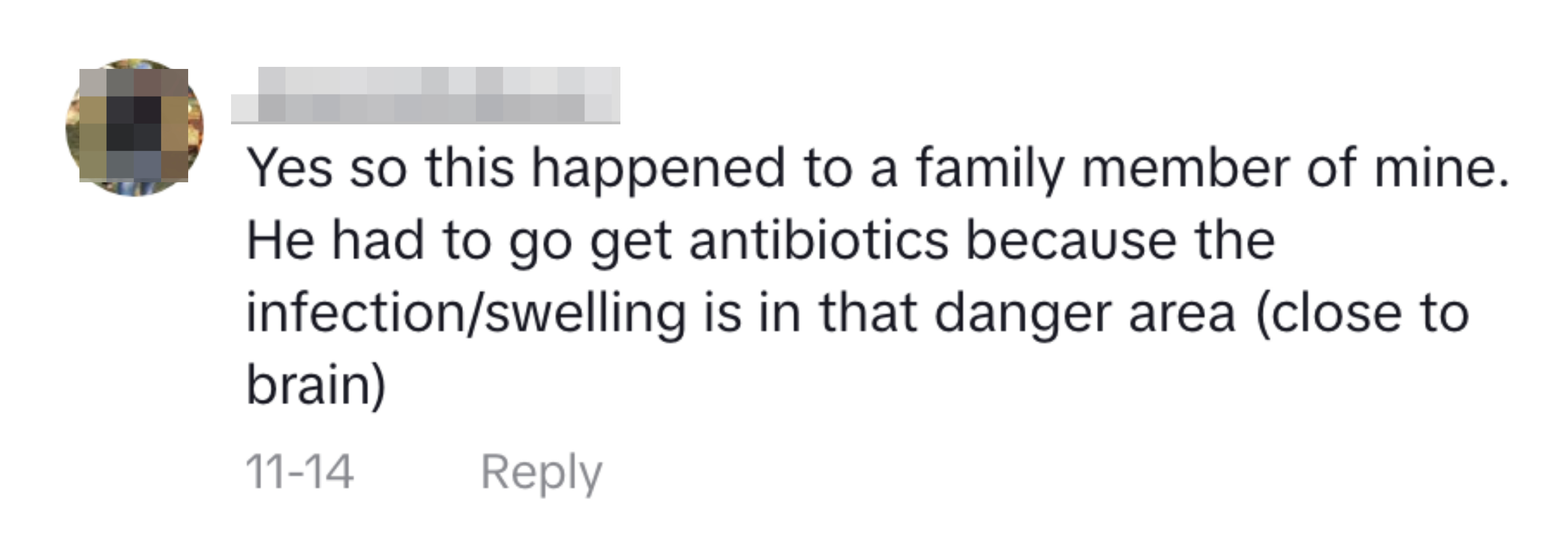 &quot;Yes, so this happened to a family member of mine. He had to go get antibiotics because the infection/swelling is in that danger area (close to the brain)&quot;