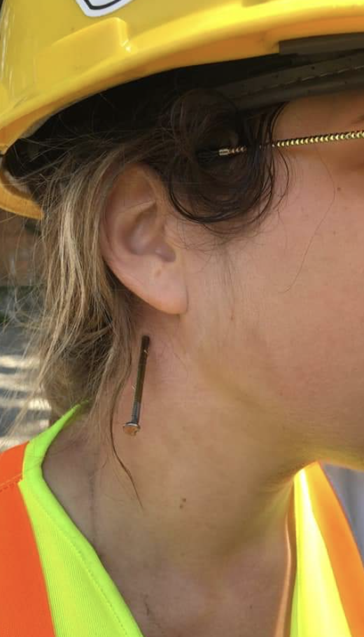 A nail in a construction worker&#x27;s neck