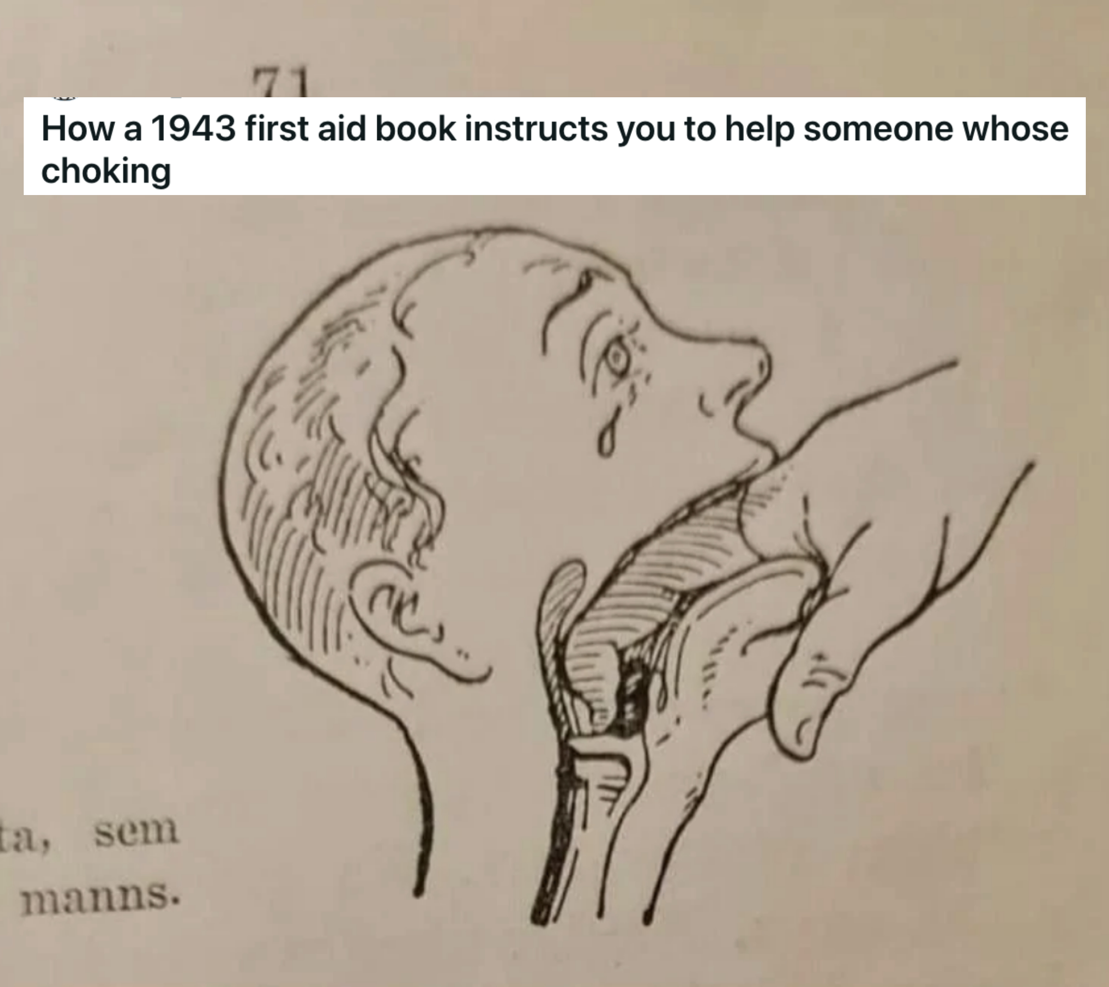 &quot;How a 1943 first aid book instructs you to help someone whose choking&quot;