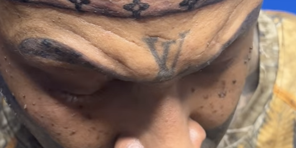 Man's Louis Vuitton Face Tattoos Go Viral - Vimarsana News