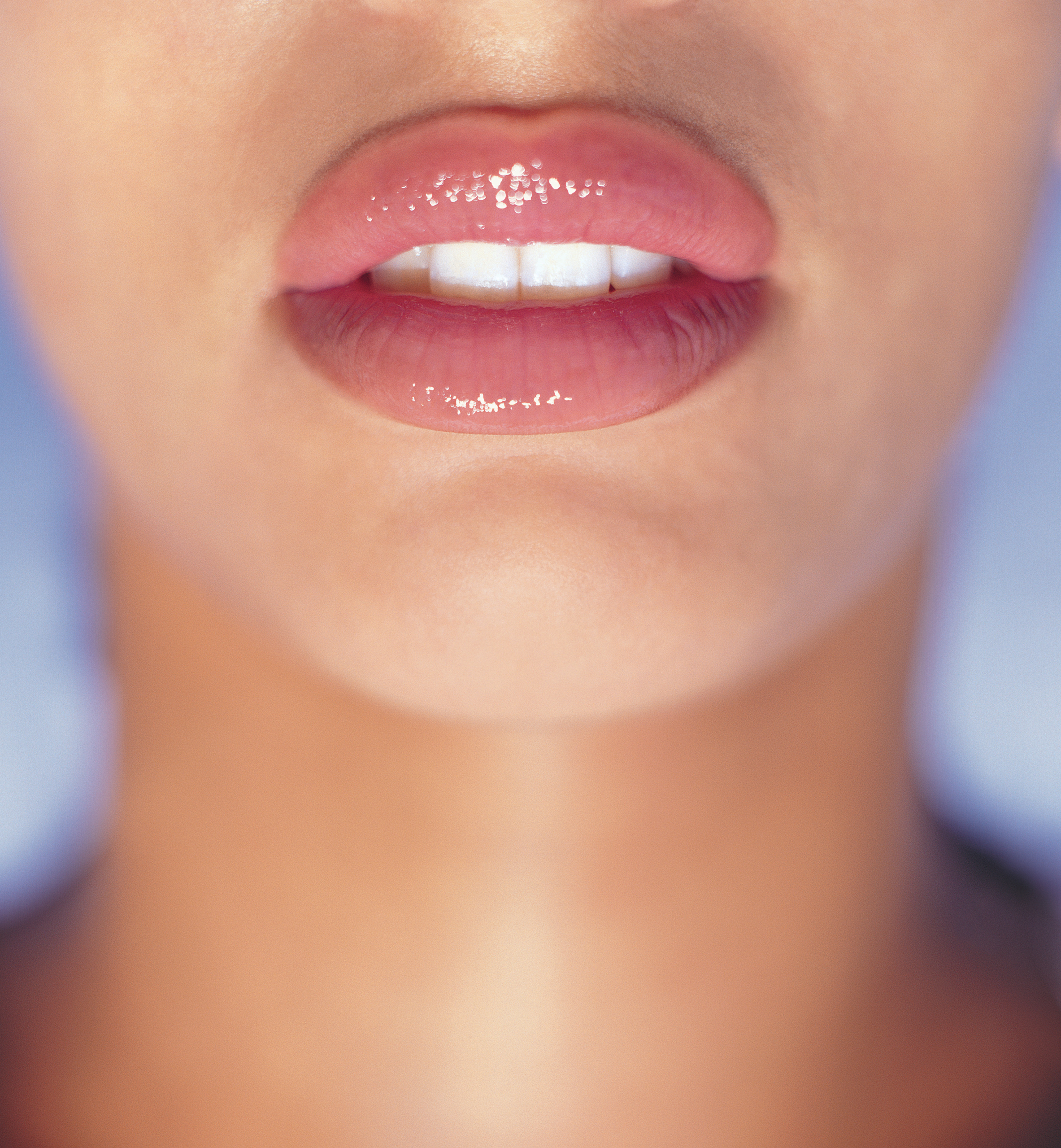 woman with overfilled lips
