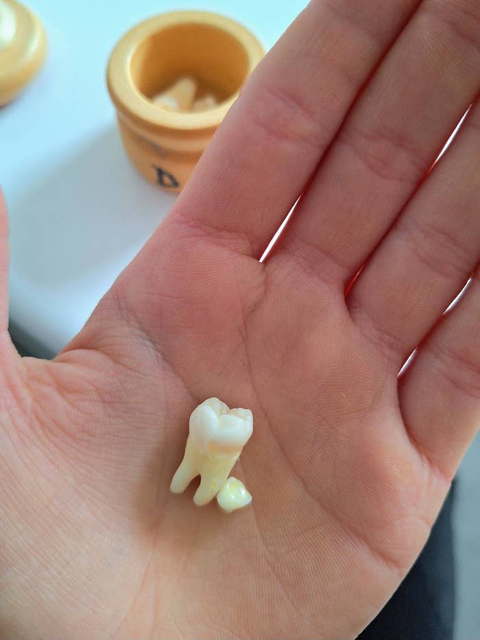 A wisdom tooth with long roots and a tiny tooth in the palm of a hand