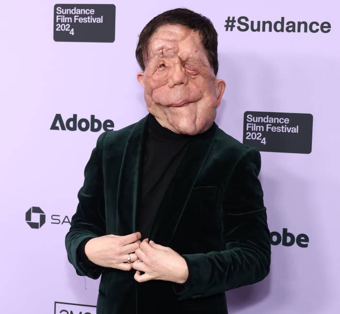 Closeup of Adam Pearson on the red carpet