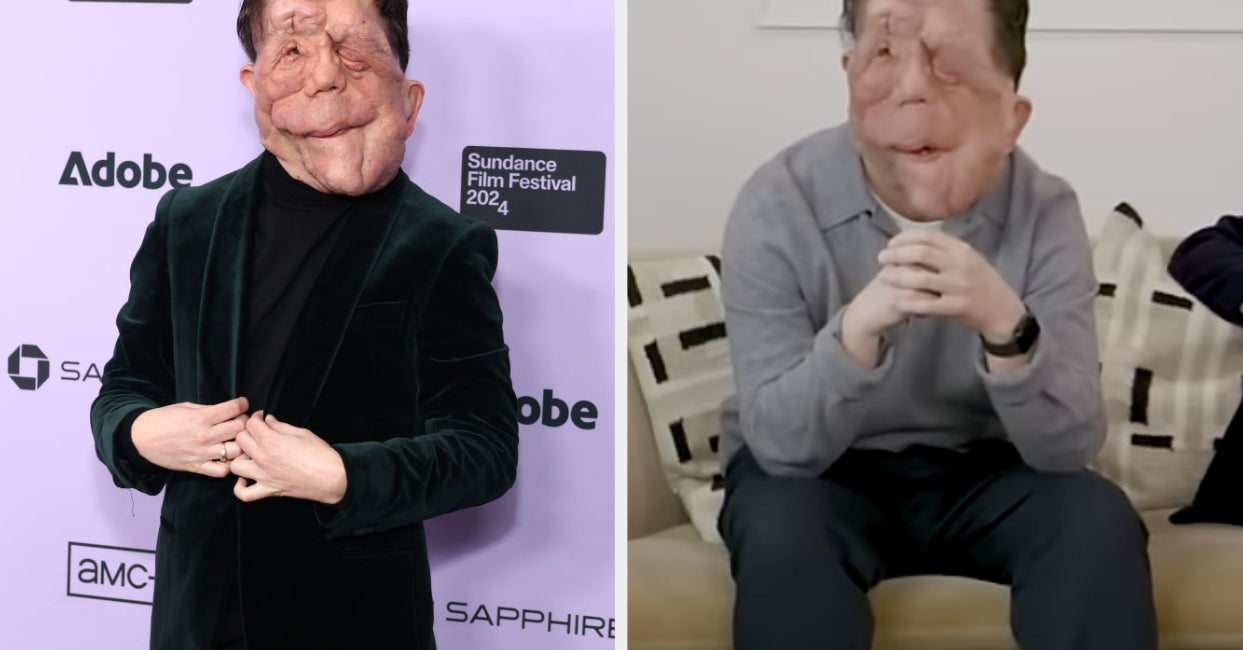 "A Different Man" Star Adam Pearson Opened Up About The "Lazy" Way