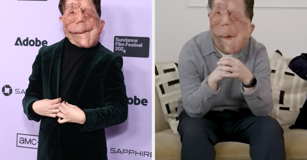 “A Different Man” Star Adam Pearson Opened Up About The “Lazy” Way Actors With Disabilities Are Portrayed In Hollywood-ZoomTech News
