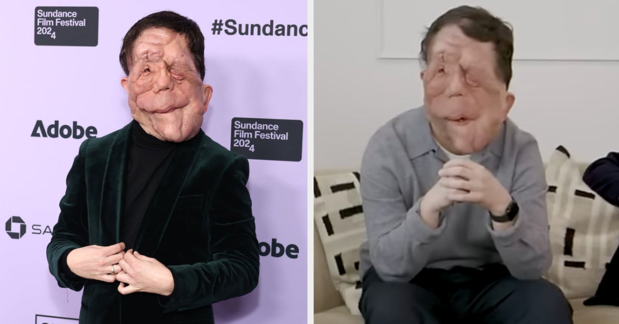 A Different Man’s Adam Pearson On Actors With Disabilites A Different Man’s Adam Pearson On Actors With Disabilites