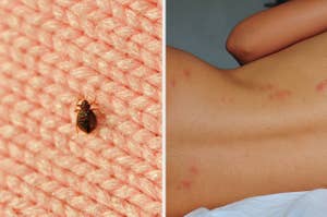 A bed bug seen on a woven blanket next to a woman's bare back with bed bug bites visible