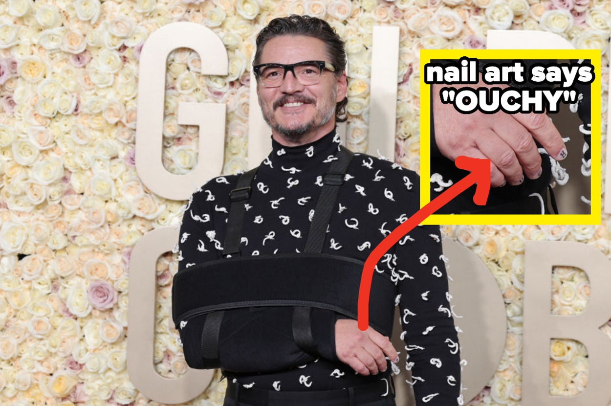 Pedro Pascal has his arm in a sling and nail art that says "ouchy"