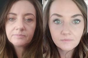 before/after of reviewer's face after using serums, with the after pic showing noticeably smoother, brighter skin with reduced fine lines