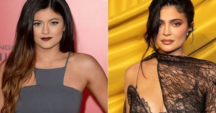 Adults Who Got Plastic Surgery As Teens Reveal Their Regrets