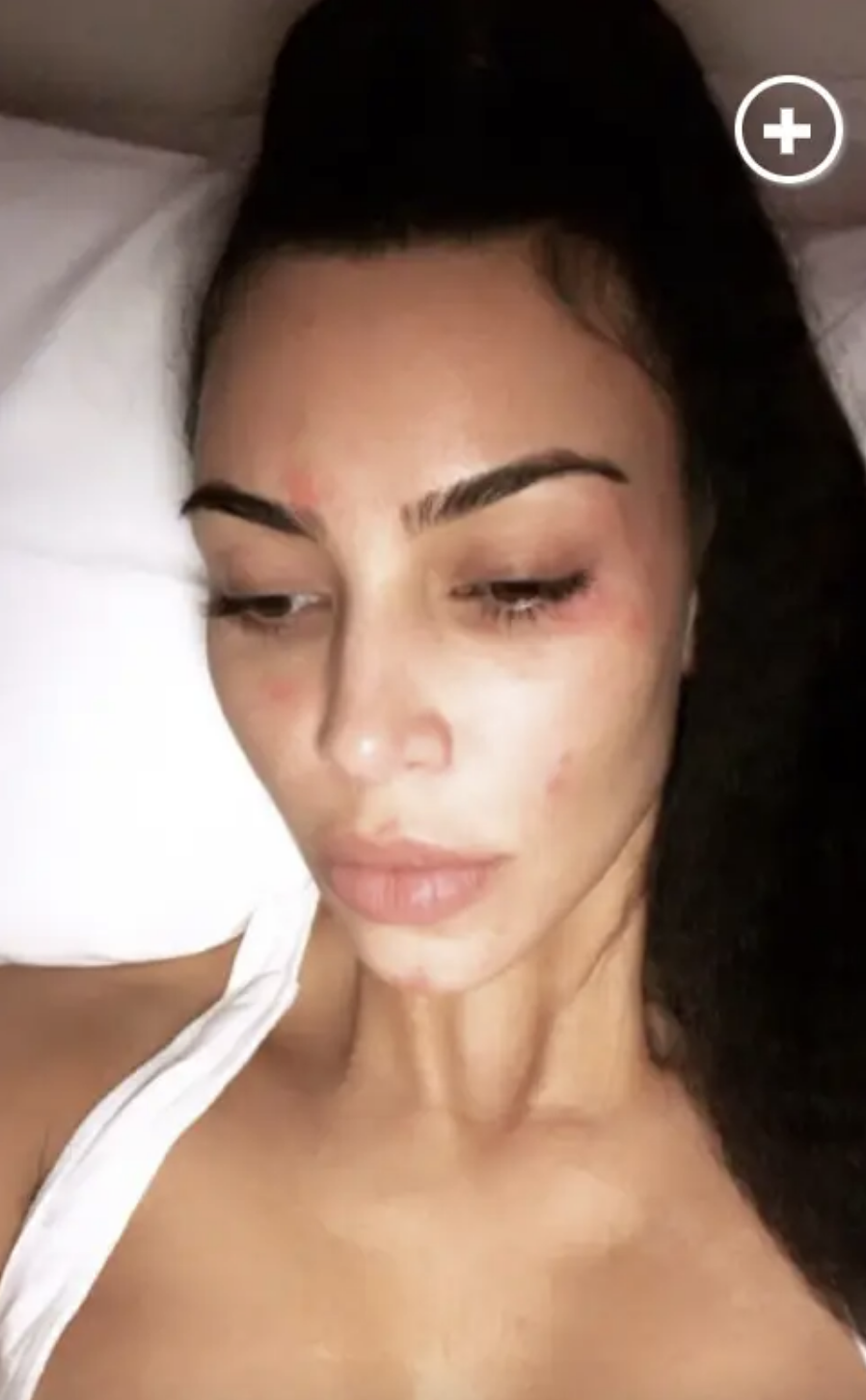 kim&#x27;s selfie with spots on her face